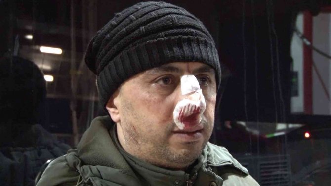 Sultanbeyli’de İ̇ett Şoförüne Tekme Tokatlı Saldırı