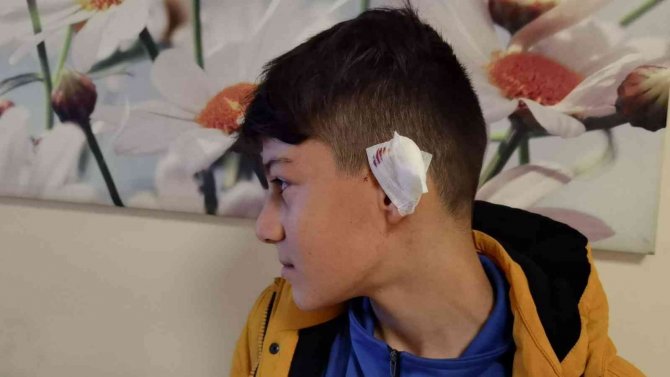 Bursa’da Başıboş Köpek Kartopu Oynayan Gence Saldırdı