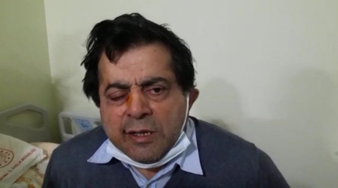 Kafasına Çatıdan Buz Kütlesi Düştü, Ölümden Döndü