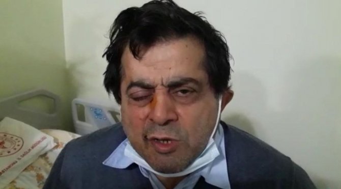 Kafasına Çatıdan Buz Kütlesi Düştü, Ölümden Döndü