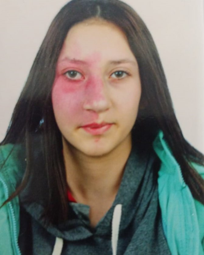 Yaklaşık 10 Ay Önce Evden Ayrılan 16 Yaşındaki Kızını Arıyor