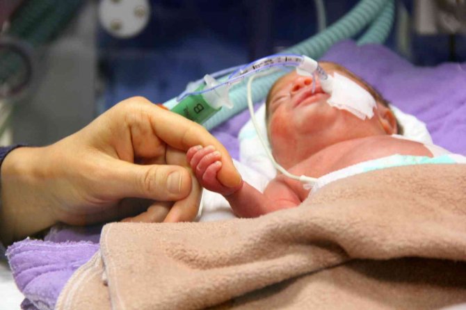 Parmak Bebeğe Kalp Ameliyatı