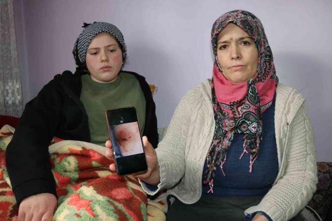 Van’da Başıboş Köpek Dehşeti
