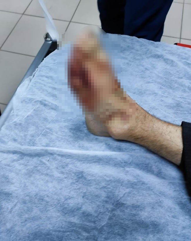 Balta İle Ayağını Kesen Şahsa Paletli Ambulans Ulaştı
