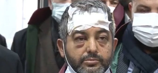 Avukata Beyzbol Sopalı Saldırıda Bulunan Sanık İçin İstenen Ceza Belli Oldu