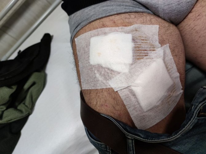 Tarladaki Çiftçi Köpeklerin Saldırısına Uğradı