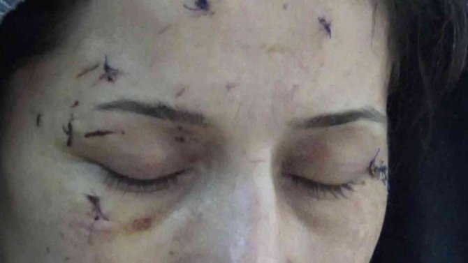 Yeğeni Elini Öpmedi Diye Dövdü, Sonra Da Yengesini 50 Yerinden Bıçakladı