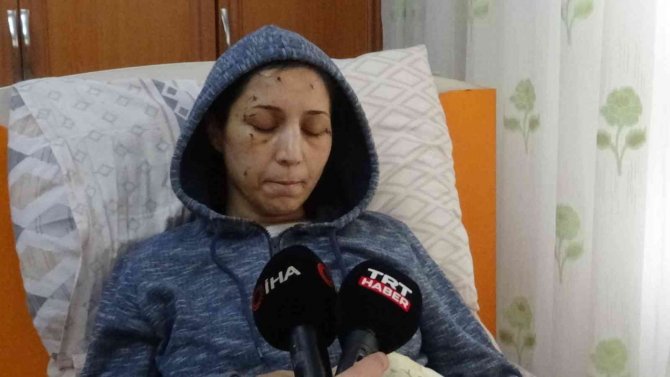 Yeğeni Elini Öpmedi Diye Dövdü, Sonra Da Yengesini 50 Yerinden Bıçakladı