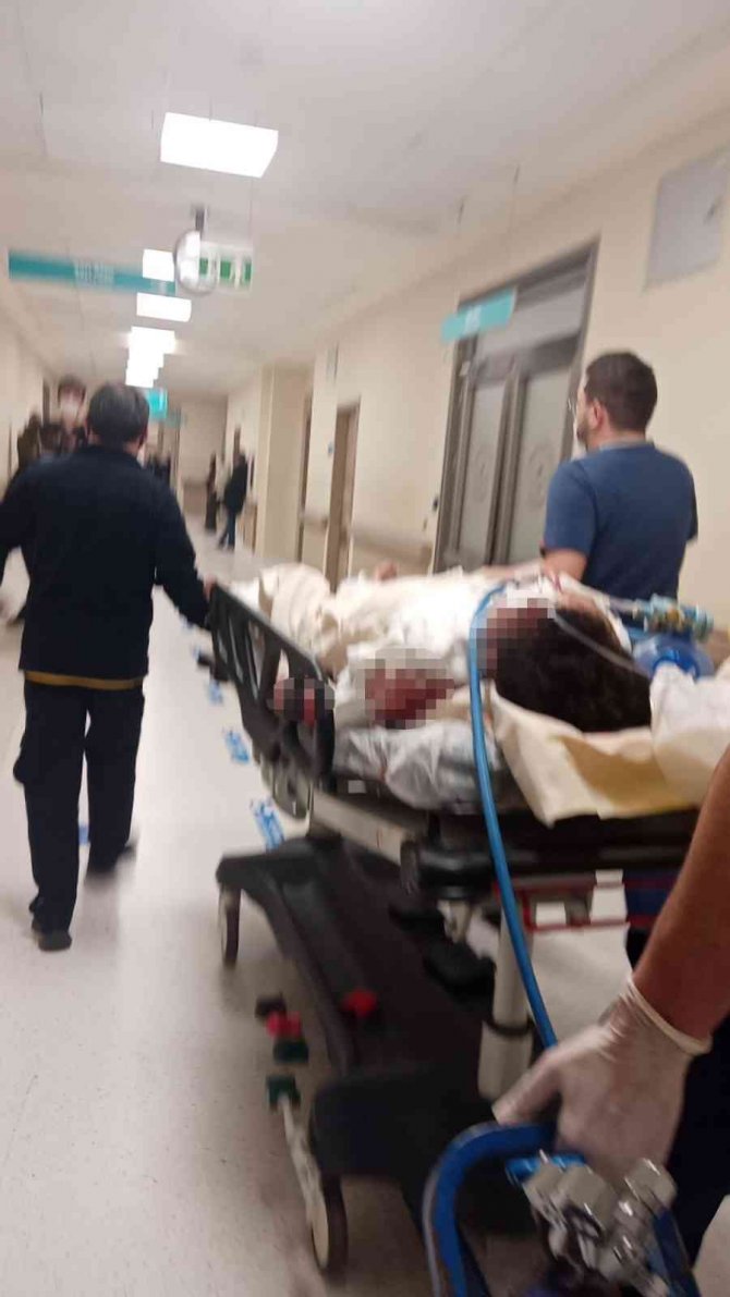 Üsküdar’da Meydana Gelen Doğal Gaz Patlamasında Yaralanan Vatandaşın Tedavisi Yanık Ünitesinde Sürüyor