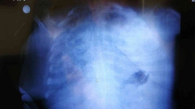 Profesör Özkaya Uyardı: "Bu Şekilde Giderse Hastalara Yer Bulamayacağız, Vatandaşın Aşı Tereddüdü Yoğun Bakımları Doldurdu"