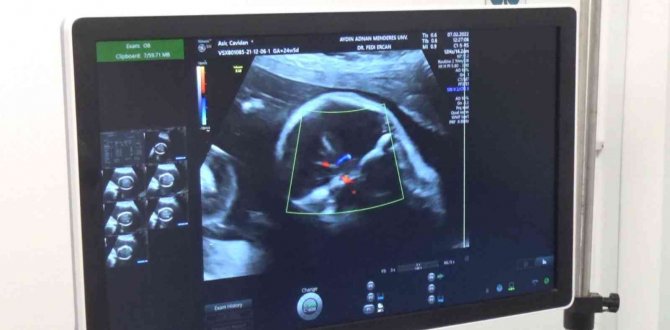 Aydın’da İlk Kez Uygulandı