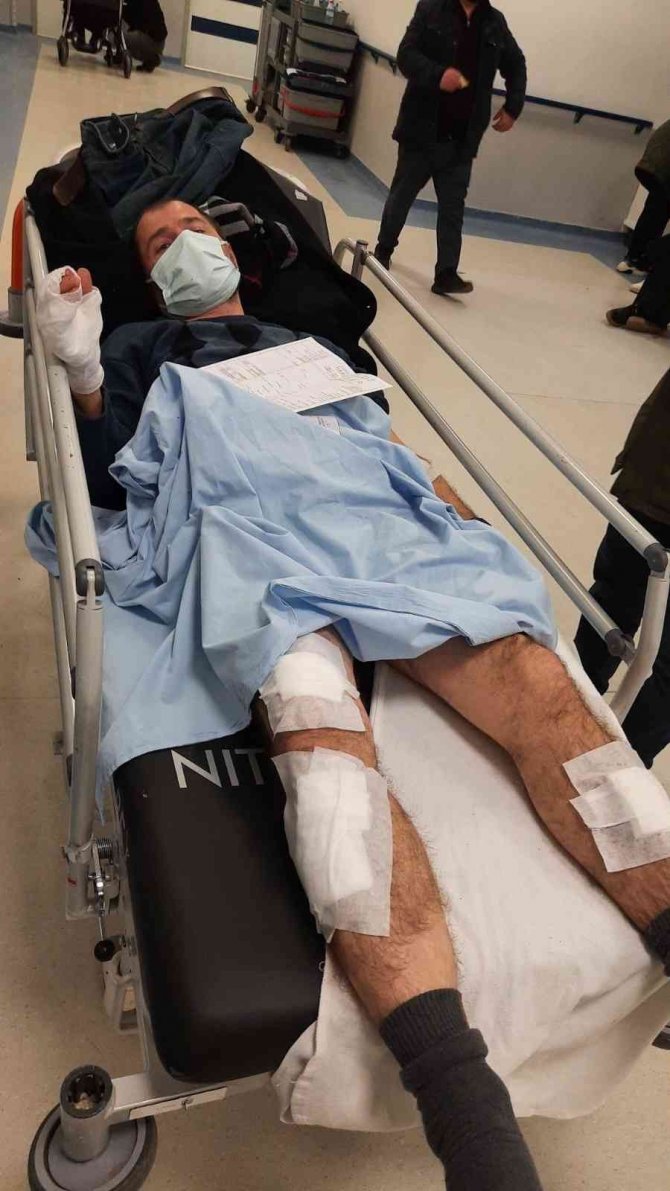Başkent’te Köpek Sürüsünün Saldırdığı Vatandaş Canını Zor Kurtardı