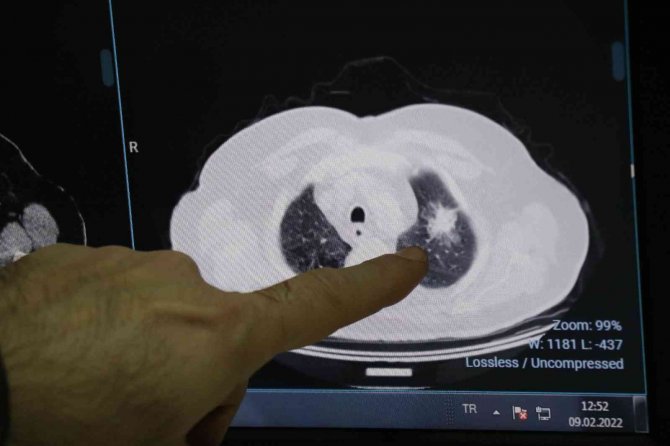 Sigaranın Zararları Anlatıldı