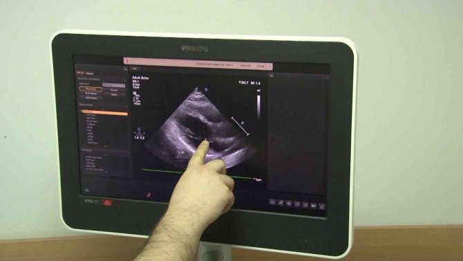 Uzmanlar, Dünya Sigarayı Bırakma Günü Kapsamında Vatandaşları Sigarayı Bırakmaya Davet Ediyor