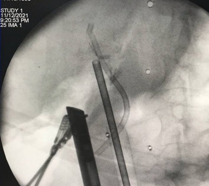 Düzce Üniversitesinden Bir İlk Daha