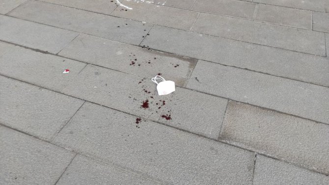 Bursa’da Belediye Başkan Yardımcısına Çirkin Saldırı