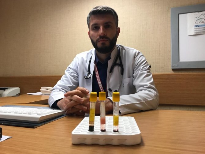 Kolesterolün Önemi Kanda Ortaya Çıktı: Düşükte Kan Berrak, Yüksekte Bulanık Ve Katı