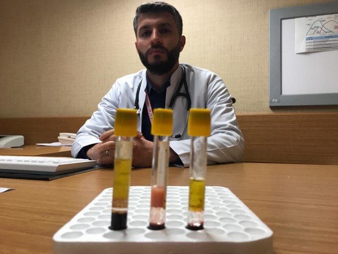 Kolesterolün Önemi Kanda Ortaya Çıktı: Düşükte Kan Berrak, Yüksekte Bulanık Ve Katı