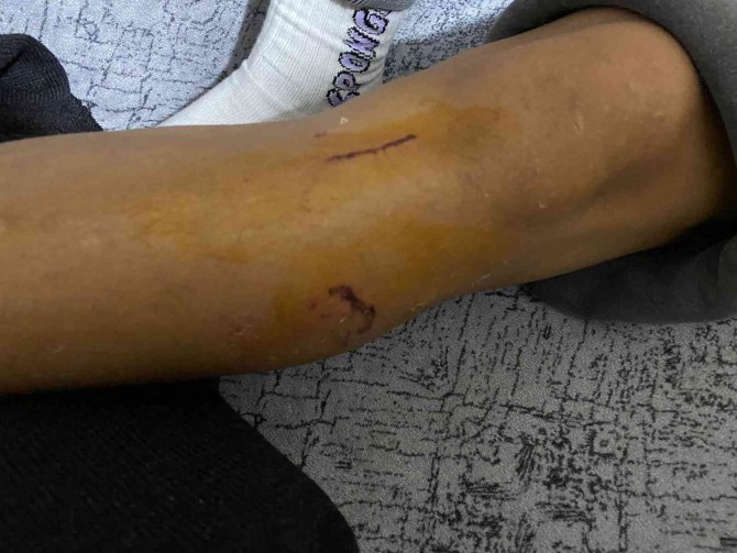 İ̇stanbul’un Göbeğinde Pitbull Dehşeti Kamerada