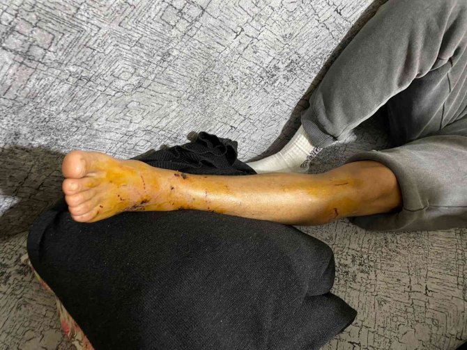 İ̇stanbul’un Göbeğinde Pitbull Dehşeti Kamerada