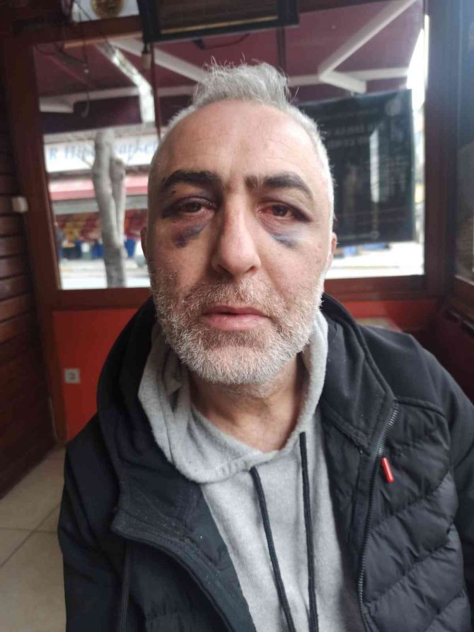 Miras Tartışmasında Nişanlısıyla Dayısına Saldırdı, O Anlar Kamerada