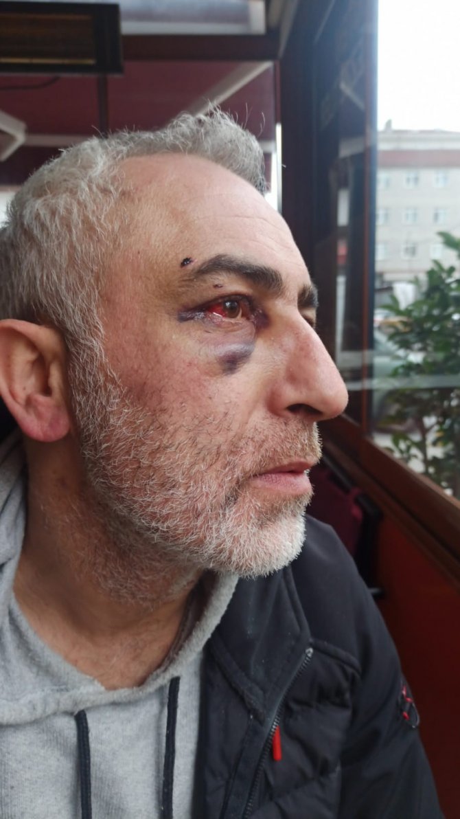Miras Tartışmasında Nişanlısıyla Dayısına Saldırdı, O Anlar Kamerada