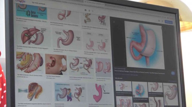 Obeziteye Bağlı Ölümler Sigara Nedenli Ölümleri Geride Bıraktı