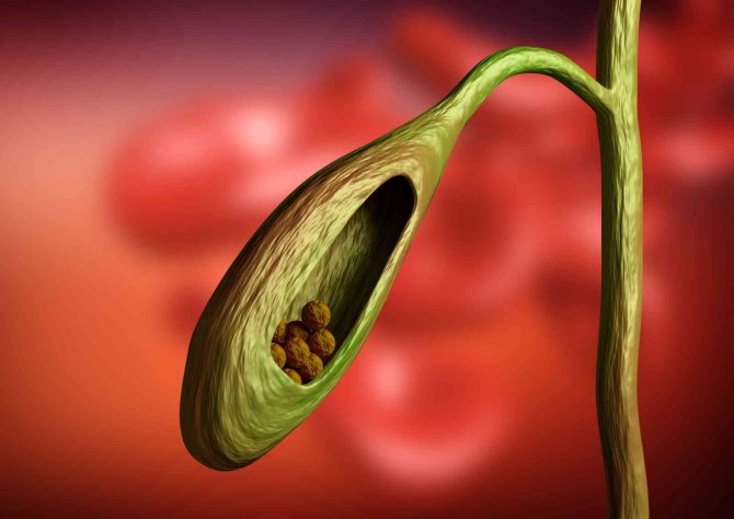 Safra Kesesi Taşını Mide Ağrısı İle Karıştırmayın