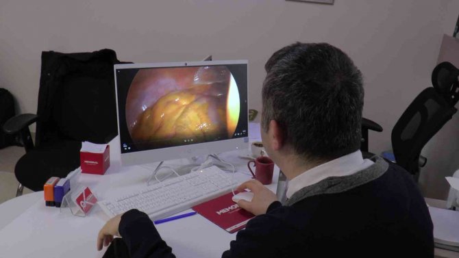 Hastalar İçin Kolay Tedavi: “Laparoskopik Cerrahi”