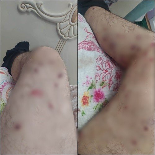 Arkadaş Kavgasını Ayırmak İsteyen Muhtar Silahla Vuruldu
