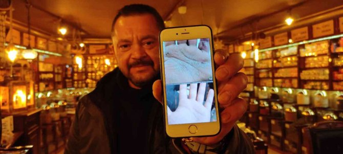 Yaptığı Bitkisel Karışımla Sedef Hastalığına Çare Buldu