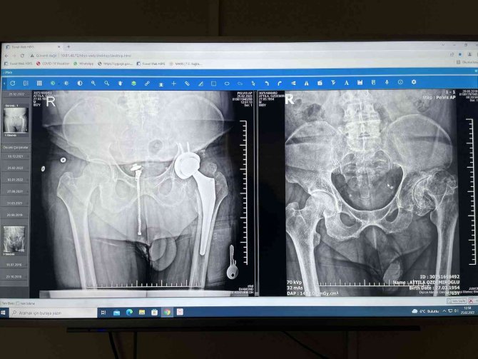 46 Yıllık Hayali Yapılan Ameliyatla Gerçekleşti