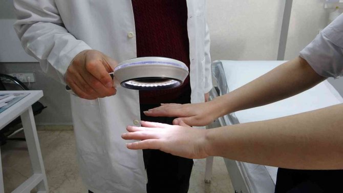 Uzmanlardan Uyarı: “Uyuz, 15-20 Yılda Bir Tüm Dünyada Salgın Halinde Gözükebilir”