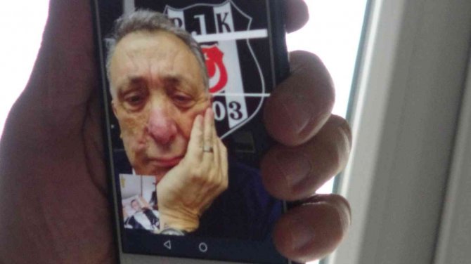 13 Yıldır Yatağa Mahkum Beşiktaş Taraftarı Başkan Çebi İle Telefonda Görüştü