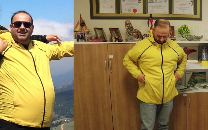 1,5 Yılda 55 Kilo Verdi, 140 Kilodan 85 Kiloya Düştü