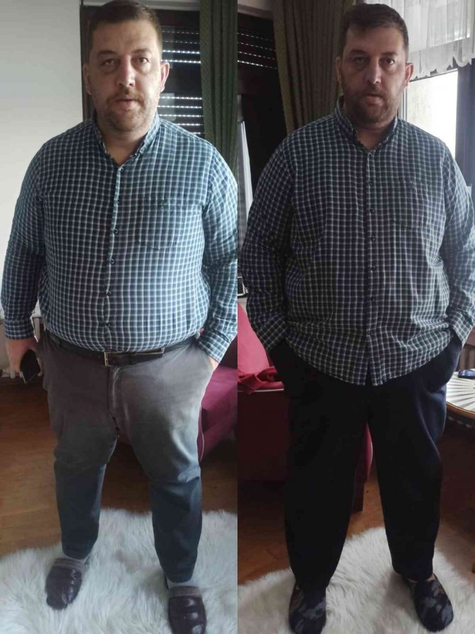 Hayatını Karartan Kilolarından Mide Ameliyatıyla Kurtuldu