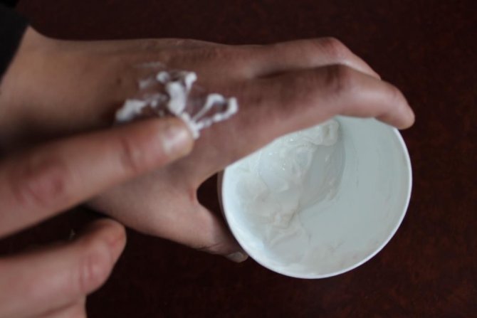 Soğuk Yanıklarına Dikkat; Kaşınma, Morarma Ve Ağrı Olabilir