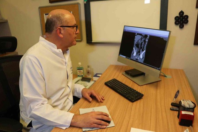 Sigara, Böbrek Kanseri Riskini Artırıyor