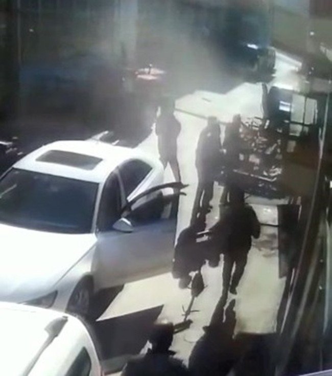 Sobadan Sıçrayan Alevler Hastanelik Etti: O Anlar Kamerada