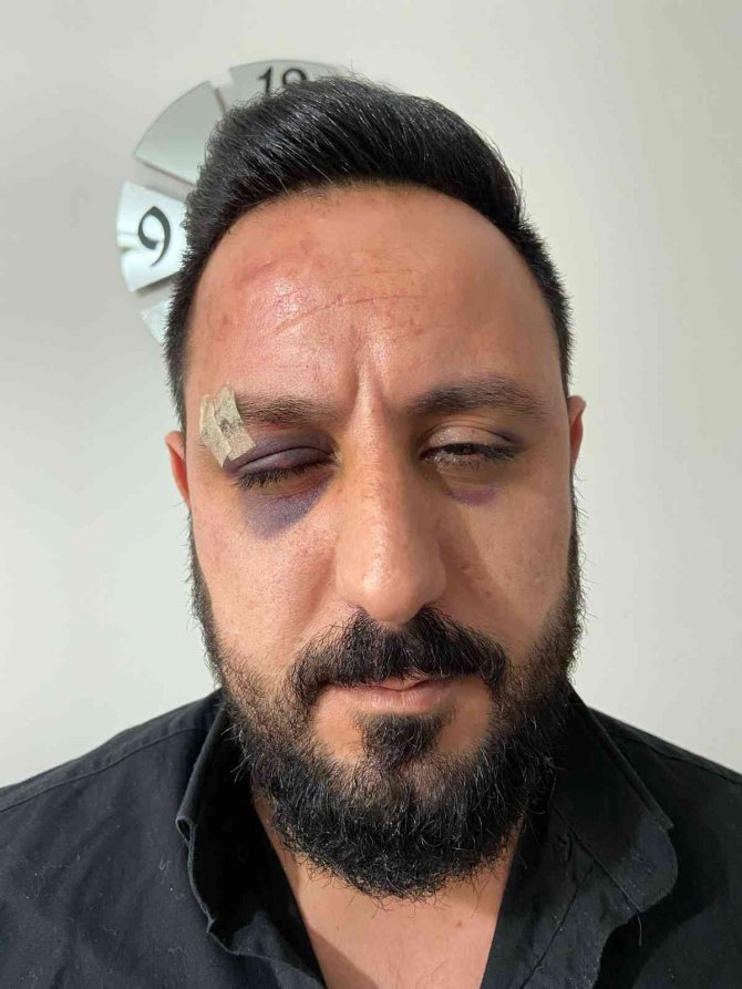 “Kime Geldiniz” Dedi Öldüresiye Dayak Yedi: Apartman İçindeki Dehşet Anları Kamerada