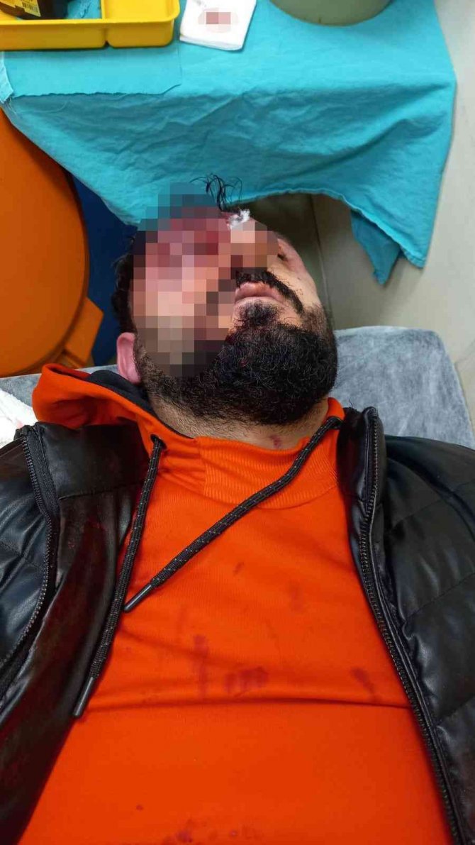 “Kime Geldiniz” Dedi Öldüresiye Dayak Yedi: Apartman İçindeki Dehşet Anları Kamerada