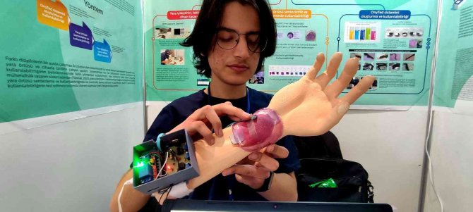 Yaralar Artık Daha Çabuk İyileşecek