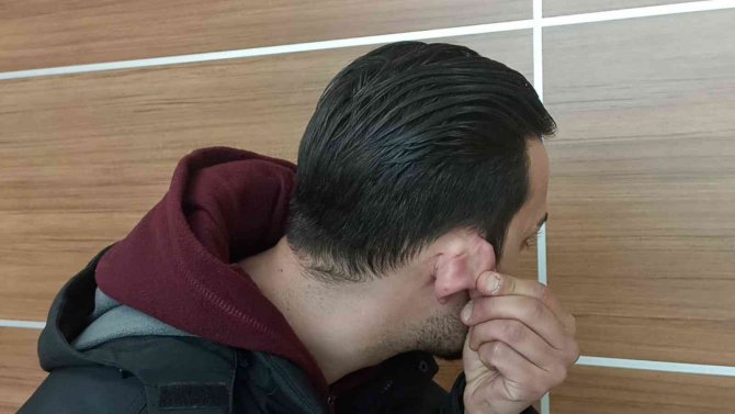 İ̇stediği Sigarayı Alamayınca Gencin Kulağını Kesti