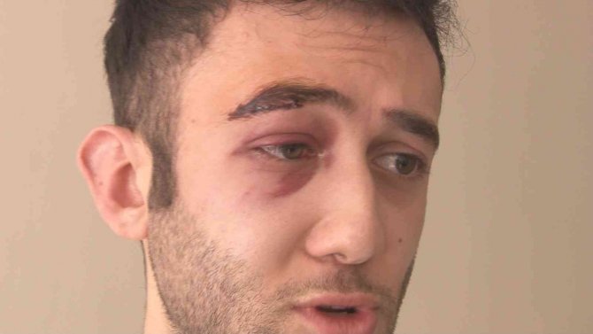 Darp Edilen A101 Çalışanı: “Bir Şeker Uğruna Saldırıya Uğradık”