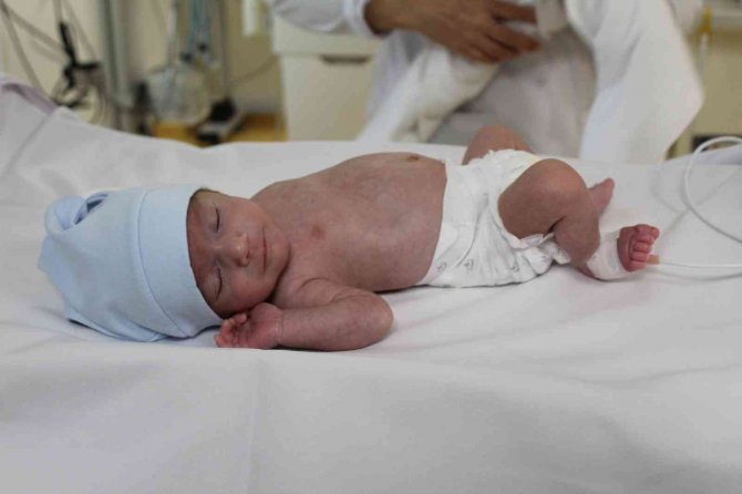 1 Kilo 300 Gramlık Ayaz Dört Elle Hayata Sarıldı