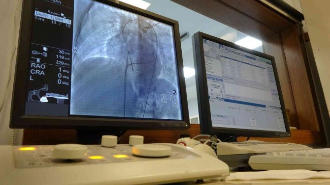 Van’da Yeni Trend Başparmaktan Anjiyo