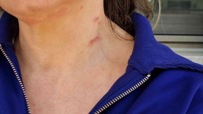 Bodrum’da Dehşet Anları