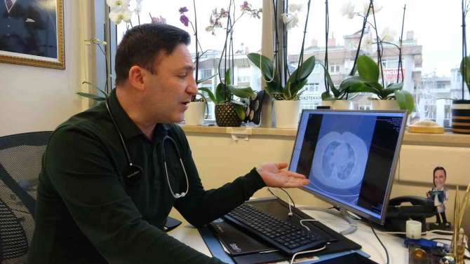 Prof. Dr. Özkaya: "Artık Dalga Beklemiyoruz, Virüsün Bulaşma Ve Hastalık Yapma Hızı Yavaşladı"