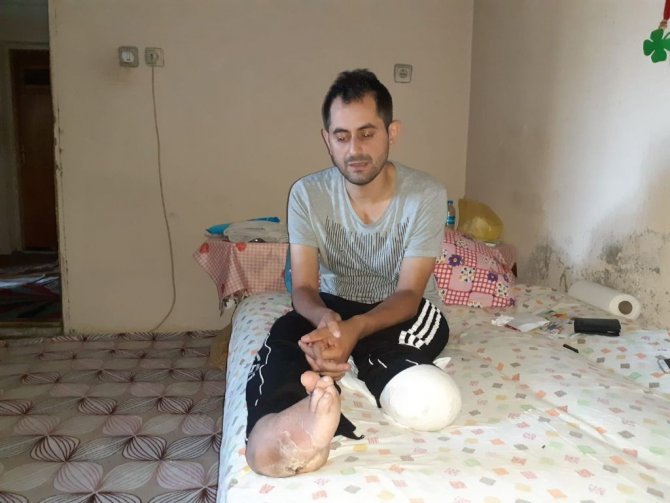 Engelli Üniversite Öğrencisinin Vefatı Osmancık’ı Hüzne Boğdu