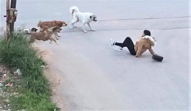 Köpeklerin Saldırdığı Genç Kızın Korku Dolu Anları Kamerada